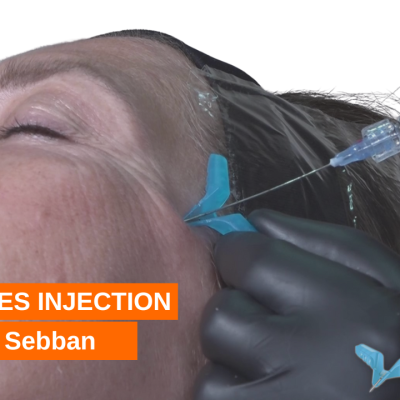 SoftFil Microcannula x Revanesse Shape+ | Cheekbones Injection ...